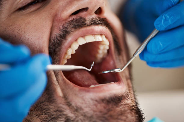 Best Orthodontic Emergency Dentist in Lake Nacimiento, CA