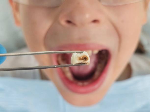 Best Emergency Dental Services for Seniors in Lake Nacimiento, CA