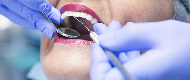 Best Emergency Dental Care for Abscessed Tooth in Lake Nacimiento, CA